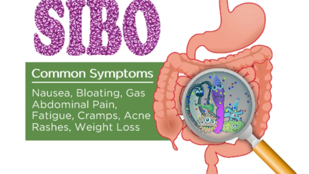 Top Signs You Should See a SIBO Specialist