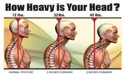 Head Tilt and Posture: How Small Misalignments Affect Your Health