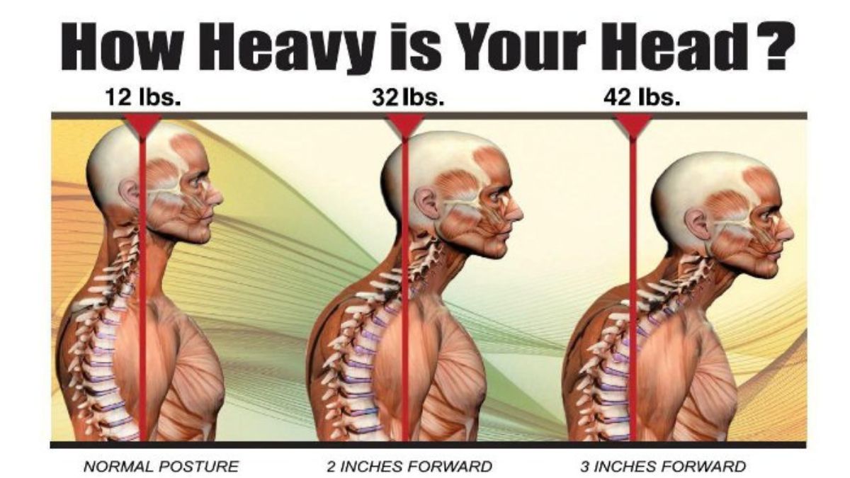 Head Tilt and Posture: How Small Misalignments Affect Your Health