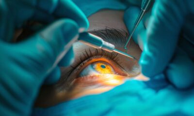 Lens Replacement Surgery: The Modern Answer to Vision Problems