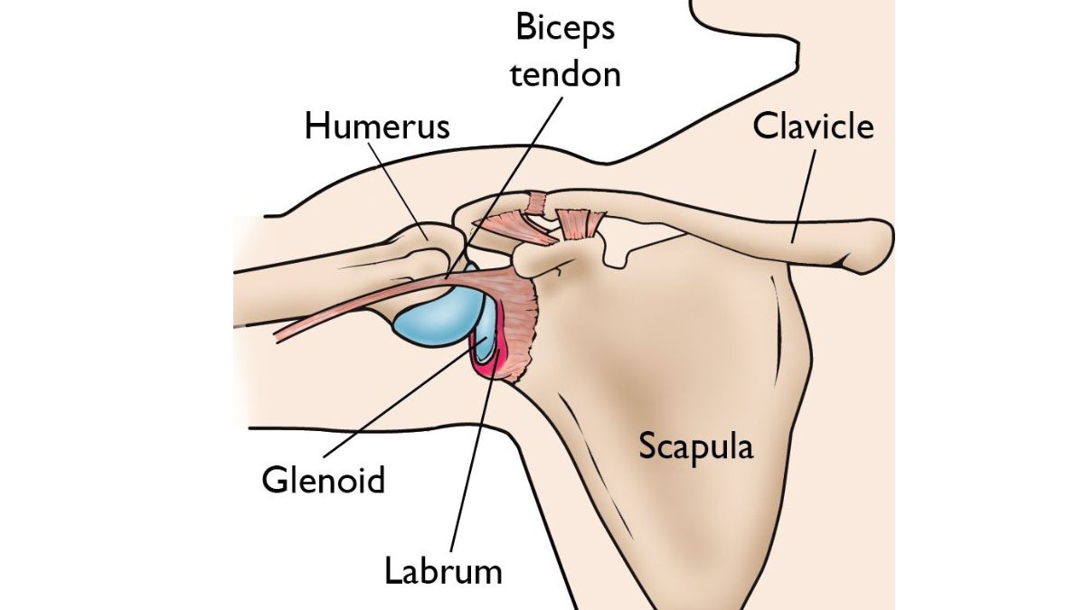 SLAP Tear